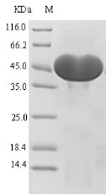 Recombinant Human ATP-citRate synthase(ACLY),partial (CSB-EP001158HU)