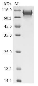 B-cell lymphoma 6 protein (BCL6) N-terminal 6xHis-tagged (E. coli-derived, recombinant human)