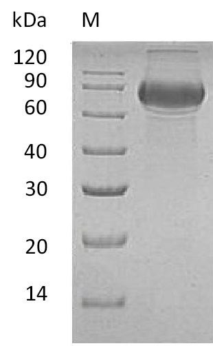 Recombinant Human B-lymphocyte antigen CD19(CD19),partial (Active) (CSB-AP005061HU)