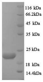 Recombinant Human Caspase-8(CASP8),partial (CSB-EP621791HU)