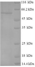 Cellular Tumor Antigen p53 (TP53) N-terminal 6xHis-SUMO-tagged (E. coli-derived, recombinant human)