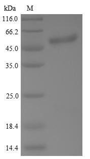Cellular Tumor Antigen p53 (TP53) N-terminal 6xHis-tagged (yeast-derived, recombinant human)