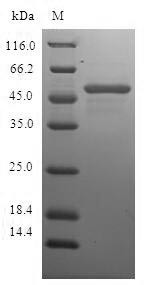 Recombinant Human Charged multivesicular body protein 2b(CHMP2B) (CSB-EP891990HU)