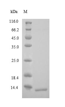 Corticotropin-Releasing Factor Receptor 1 (CRHR1) partial, N-terminal 6xHis-tagged (yeast-derived, recombinant human)