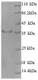 Recombinant Human Cyclin-dependent kinase 4(CDK4) (CSB-EP005065HU)