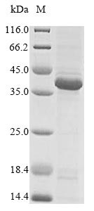 Recombinant Human Ephrin type-A receptor 2(EPHA2),partial (CSB-EP007722HU1)