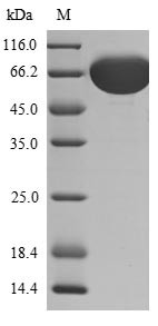 Fibroblast Growth Factor Receptor 1 (FGFR1) partial, N-terminal 6xHis-sumostar-tagged (yeast-derived, recombinant human)