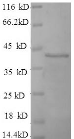 Fibroblast Growth Factor Receptor 3 (FGFR3) partial, N-terminal 6xHis-tagged (E. coli-derived, recombinant human)