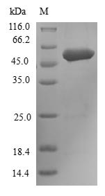 Fibroblast Growth Factor Receptor 3 (FGFR3) partial, N-terminal 6xHis-B2M-tagged (E. coli-derived, recombinant human)
