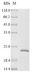 Insulin-like growth factor 1 receptor (IGF1R) partial, N-terminal 10xHis-tagged (mammalian cell-derived, recombinant human)