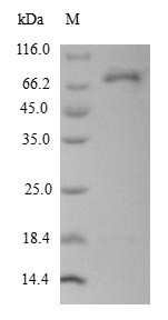 Recombinant Human L-dopachrome tautomerase (DCT),Partial (CSB-EP006562HU)