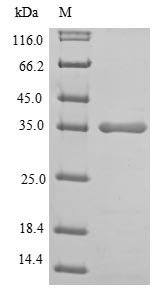 Recombinant Human L-lactate dehydrogenase A chain(LDHA),partial (CSB-EP012832HU1e1)