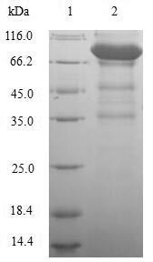Recombinant Human Lymphocyte activation gene 3 protein(LAG3),partial (CSB-EP012719HU1)