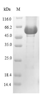 Recombinant Human Lysosomal acid glucosylceramidase(GBA) (CSB-EP009289HUb0)