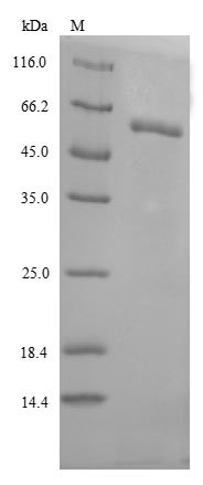 Recombinant Human Lysosomal acid glucosylceramidase(GBA) (CSB-EP009289HUe1)