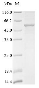 Recombinant Human Lysosomal acid glucosylceramidase(GBA)(N409S) (CSB-BP009289HU(M))