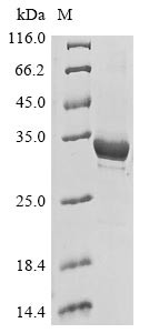 Recombinant Human Microtubule-associated protein 1A(MAP1A),partial (CSB-EP013400HU)