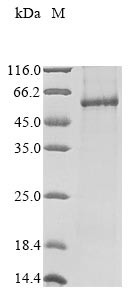 Recombinant Human NADPH oxidase 1(NOX1) (CSB-CF015959HU)
