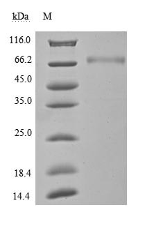 Recombinant Human Programmed cell death 1 ligand 1(CD274),partial (Active) (CSB-MP878942HU1)