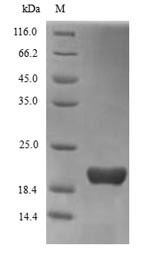 Recombinant Human Triggering receptor expressed on myeloid cells 2(TREM2),partial (CSB-YP024405HU)