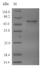 Tubulin Beta-4A Chain (TUBB4A) (CSB-EP025324HU) (E. coli-derived, recombinant human)