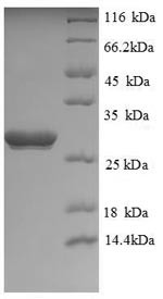 Recombinant Human Ubiquitin carboxyl-terminal hydrolase isozyme L1(UCHL1),partial (CSB-EP025541HU1)