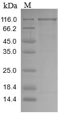 Recombinant Human Vacuolar protein sorting-associated protein 35(VPS35) (CSB-BP839401HUd8)