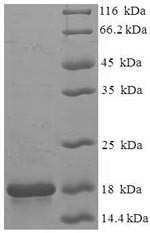 Recombinant Macaca fascicularis Frataxin, mitochondrial(FXN) (CSB-EP810224MOV)