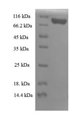 Recombinant Mouse Importin subunit beta-1(Kpnb1) (CSB-EP012490MO)