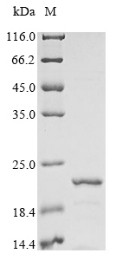 Beta-Synuclein (SNCB) N-terminal 10xHis-tagged (E. coli-derived, recombinant rat)