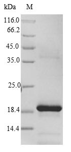 Recombinant Rat Frataxin, mitochondrial(Fxn) (CSB-EP009086RAe1)