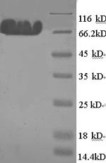 Microtubule-associated protein tau (Mapt) N-terminal 6xHis-tagged (E. coli-derived, recombinant rat)