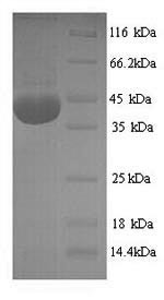 Recombinant Rat NADPH oxidase 4(Nox4),partial (CSB-YP015961RA)