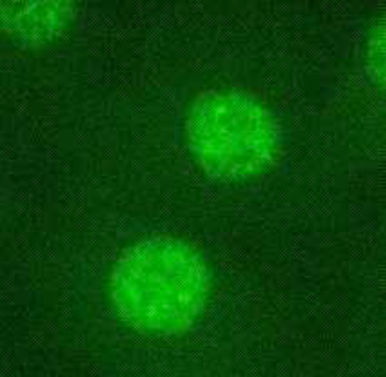 Anti CCAAT/Enhancer-Binding Protein Beta (C/EBP Beta) mAb (Clone 7D2)
