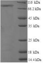 CD44 Antigen (CD44) partial, N-terminal 6xHis-SUMO-tagged (E. coli-derived, recombinant human)