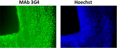 Anti Transcription Activator BRG1 (SMARCA4) mAb (Clone 3G4)
