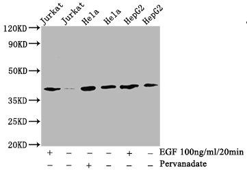 Anti Phospho-LAT (Y191) mAb (Clone 2E4)