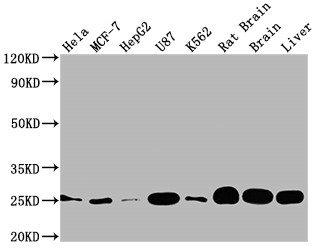 Anti SOD2 mAb (Clone 10F6)