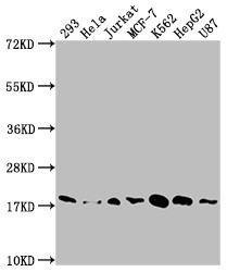 Anti SOD1 mAb (Clone 3E5)
