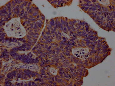 Anti CXCL10 mAb (Clone 5C7)