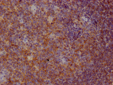 Anti CD22 mAb (Clone 3D8)