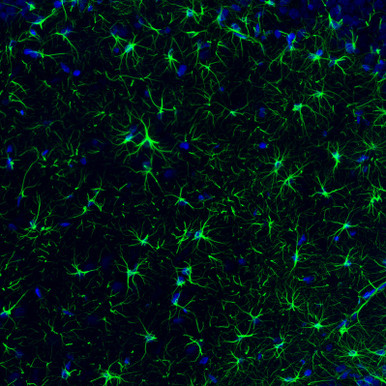 Anti GFAP mAb (Clone CL2713, ATL-AMAb91033 w/enhanced validation)