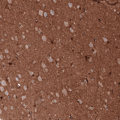 Anti GAPDH mAb (Clone CL3265, ATL-AMAb91152 w/enhanced validation)