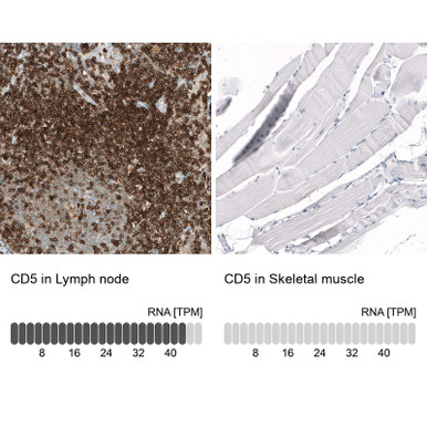 Anti CD5 mAb (Clone CL12334, ATL-AMAb91782 w/enhanced validation)