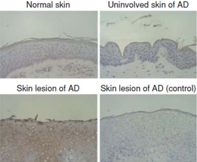 Anti Serpin B3 (SCCA1/T4-A) and Serpin B4 (SCCA2/Leupin) pAb (Rabbit, Antiserum)