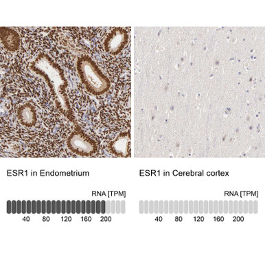Anti ESR1 pAb (ATL-HPA000449 w/enhanced validation)