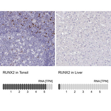 Anti RUNX2 pAb (ATL-HPA022040 w/enhanced validation)