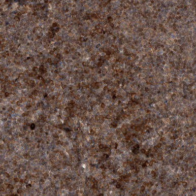 Anti RAB3GAP2 pAb (ATL-HPA027299)