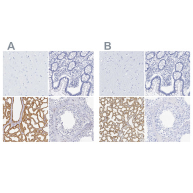 Anti LALBA pAb (ATL-HPA029855 w/enhanced validation)