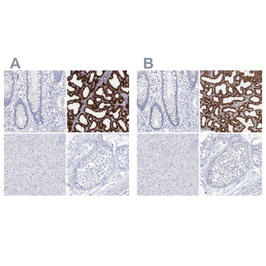 Anti CSN3 pAb (ATL-HPA035953 w/enhanced validation)